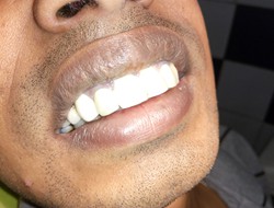 31
